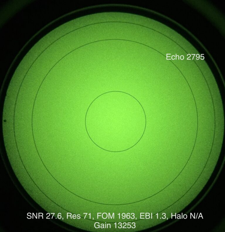 Echo GP 2795
